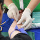 Yellow Fever Vaccination Requirements in Rwanda, Uganda, and Congo